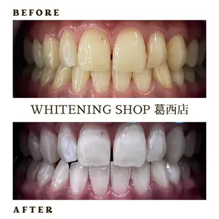 ホワイトニング ショップ葛西店のその他イメージ