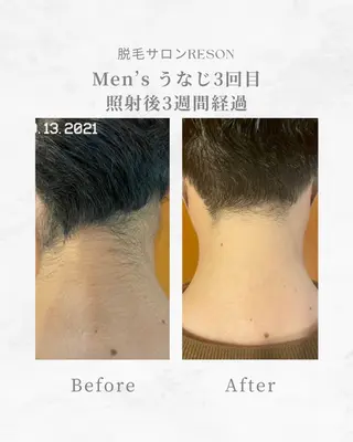 メンズ RESON 調布店所属・都度払いの脱毛サロン RESONのエステ・リラクイメージ