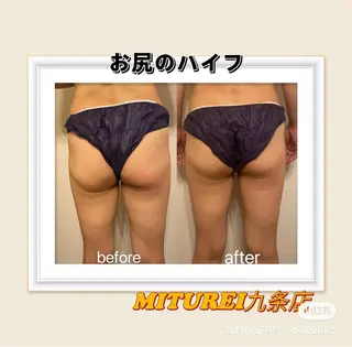 西区九条エステ MITUREIサロンのエステ・リラクイメージ