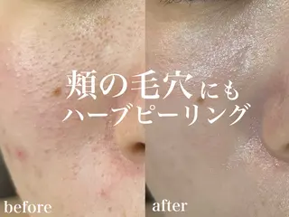 WHITE AQUA 北千住店のエステ・リラクイメージ