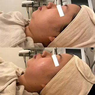 ✨美肌水光✨ アトリエリュバンのエステ・リラクイメージ