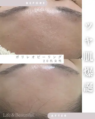 Life＆ Beautifulのエステ・リラクイメージ