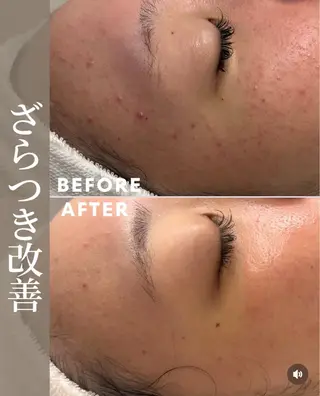 肌育成サロン ♡ 村田理紗のエステ・リラクイメージ