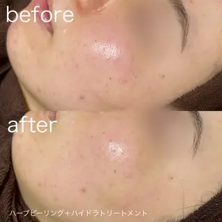 lulularico Yuのエステ・リラクイメージ