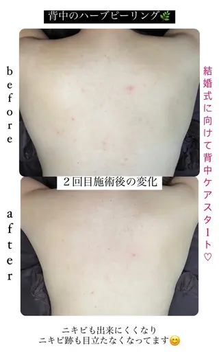 ベラージュ【美背中・ 美尻・フェイシャル】のエステ・リラクイメージ