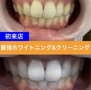 ホワイトニングサロン ダンブランシュサンダのその他イメージ