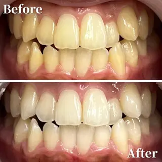 LBSホワイトニング 銀座店💎公式のその他イメージ