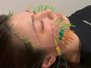 美容鍼灸Solana所属・小櫻 唯のエステ・リラクイメージ