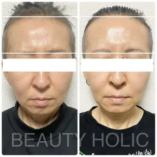 ニキビ・ 肌荒れ専門店のエステ・リラクイメージ