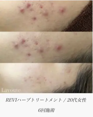 ネイル&エステ phuan(プアン)のネイルデザイン