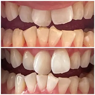 カラー 💎ダイヤモンド ホワイトニング渋谷のその他イメージ