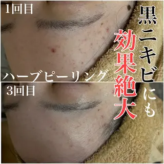 WHITE AQUA 北千住店のエステ・リラクイメージ