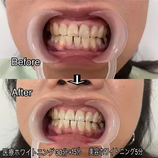西宮ホワイトニング Kirarie所属・志水 有美のエステ・リラクイメージ