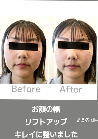 EL.ALLY イーエル.アリーのエステ・リラクイメージ