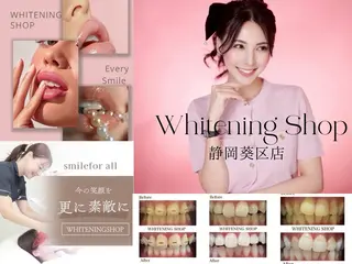 ホワイトニングショップ静岡葵区店所属・ホワイトニング ショップ静岡葵区店のその他イメージ