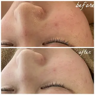 メンズ メナード岐阜茜部 杉浦のエステ・リラクイメージ