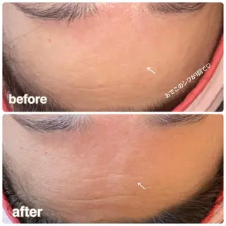 FLEUR大阪・整体 ・ハイフ・痩身・小顔のエステ・リラクイメージ