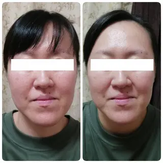 未病ケアサロン EMINY所属・未病ケアサロン EMINY☺︎勝俣のエステ・リラクイメージ