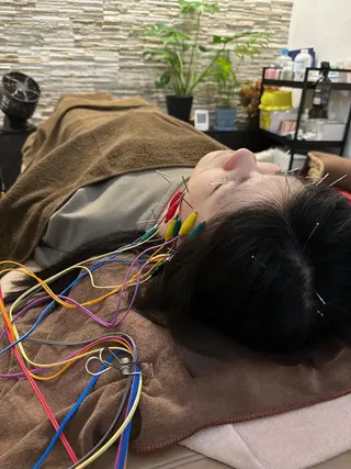 美容鍼灸整体サロンBeauJu所属・小顔矯/美容鍼/鍼灸 BeauJuのその他イメージ