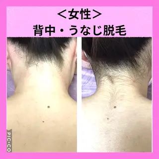 メディカルエステ マドンナのエステ・リラクイメージ