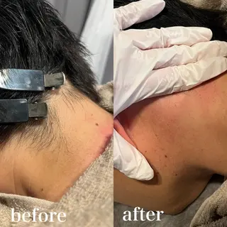 メンズ wax脱毛専門店 ハイラントのエステ・リラクイメージ