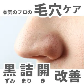 毛穴ケア＆脱毛サロン　ADEL WEISS所属・毛穴ケア＆脱毛サロン ADEL　WEISSのエステ・リラクイメージ