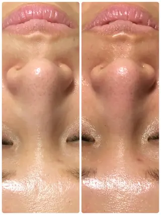 private salon  Dea_maris シュガーリング＆パーソナルボディケア所属・シミ改善・韓国肌管理 ボディメイク痩身のその他イメージ