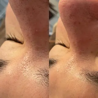 VERY VERY九条店所属・ベリーベリー🌹 九条店のエステ・リラクイメージ