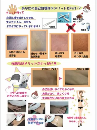 Rene 慢性疲労ケアサロンのエステ・リラクイメージ