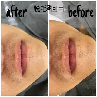 メンズ 毛穴洗浄・痩身・脱毛 /アルカンジュのエステ・リラクイメージ