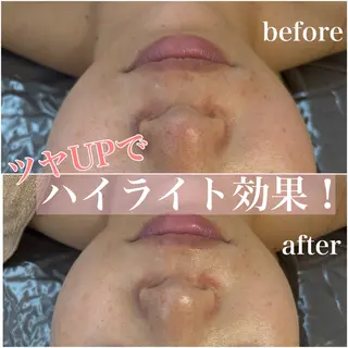 WHITE AQUA 北千住店のエステ・リラクイメージ