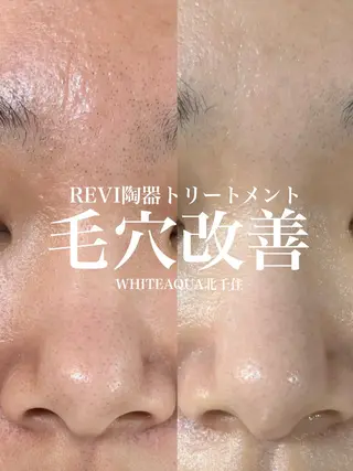 WHITE AQUA 北千住店のエステ・リラクイメージ