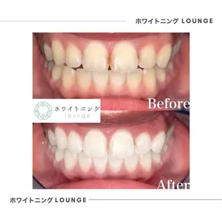ホワイトニングラウンジ横須賀所属・ホワイトニング Lounge横須賀のその他イメージ
