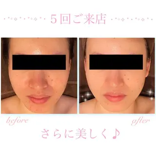 ダイエット・美肌ケア fleurのエステ・リラクイメージ