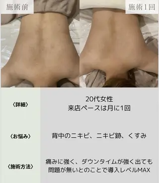 脱毛・眉毛・フェイス サロンN久留米店のその他イメージ