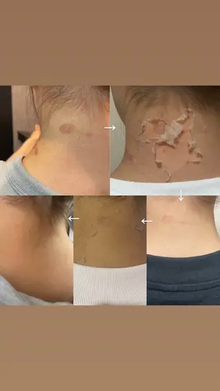 brilliance所属・老化肌トラブル肌専門 Brillianceのエステ・リラクイメージ