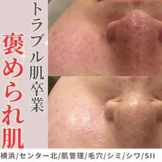 sii センター北 MANAのエステ・リラクイメージ