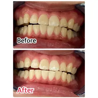 プラチナムビューティー柏所属・【歯科提携】柏ホワイ トニングスタイルのその他イメージ