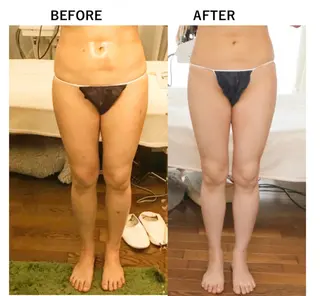 RENsalon大阪 体質改善リトリートのエステ・リラクイメージ