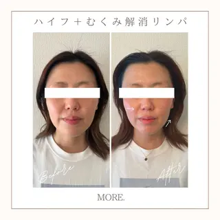 MORE. NEMAのエステ・リラクイメージ