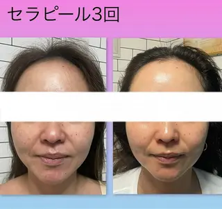 Ageing salon Be.所属・エイジングサロンビー EMIのエステ・リラクイメージ