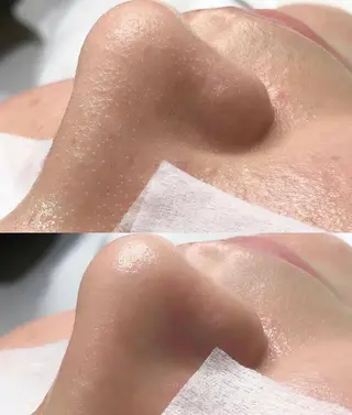 OPREA 千種店のエステ・リラクイメージ