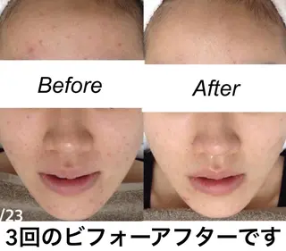 都度払い肌質改善 &脱毛Blancheのエステ・リラクイメージ