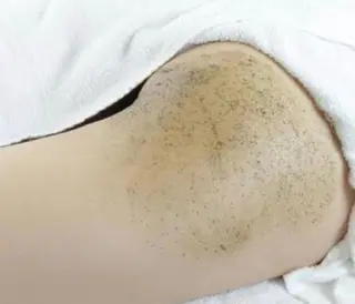 ☺ハーブピール💕 ソフィアカロン💖のエステ・リラクイメージ