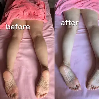 肩こり・腰痛改善専門 1万人以上施術の碧人のエステ・リラクイメージ