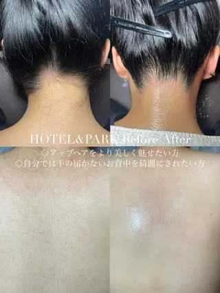 HOTEL&PARK Mikuワックス脱毛のエステ・リラクイメージ