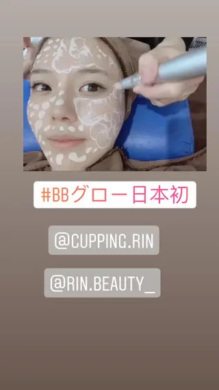 カッピング＆カッサ専門店凜所属・川嶋 凜のエステ・リラクイメージ