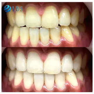 LBSホワイトニング 銀座店💎スタッフ峯のその他イメージ