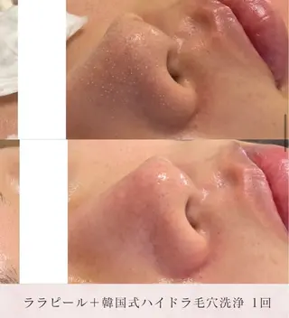 毛穴レス美肌へ🌿 看護師Abe🌼のエステ・リラクイメージ