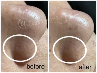 デ・アイム新潟北所属・サイトウ .のエステ・リラクイメージ